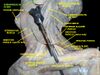 Submandibular gland lateral view