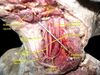 Muscles, arteries and nerves of neck.Newborn dissection.