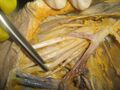 Dissection of human axilla
