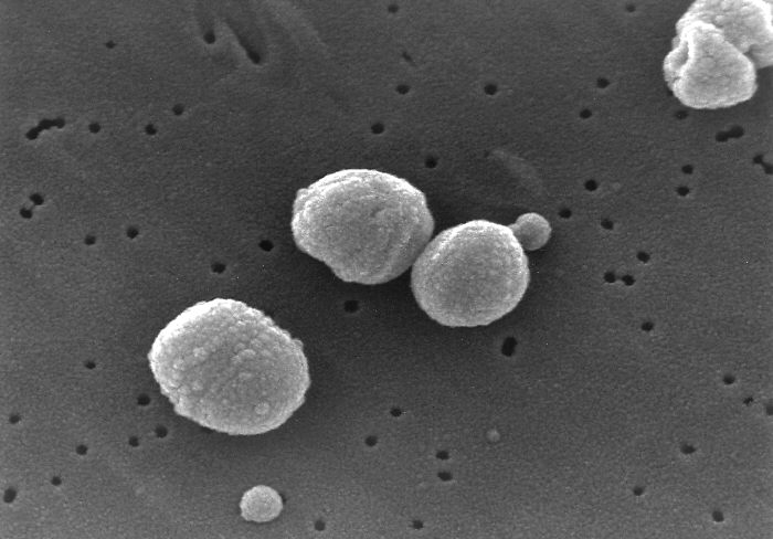 ملف:Streptococcus pneumoniae.jpg