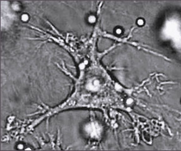 ملف:Dendritic cell.JPG