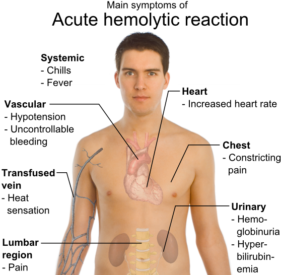 ملف:Main symptoms of acute hemolytic reaction.png