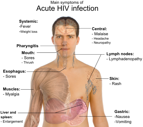ملف:Symptoms of acute HIV infection.png