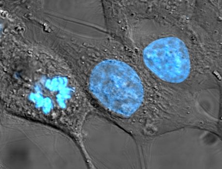 ملف:HeLa cells stained with Hoechst 33258.jpg