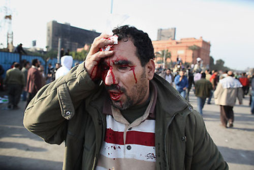 ملف:أحد ضحايا الاشتباكات مع الشرطة في محافظة الوادي الجديد 9 فبراير 2011.jpg