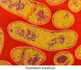 Botulism bacteria.jpg