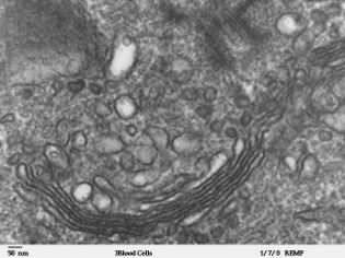 ملف:Human leukocyte, showing golgi - TEM.jpg