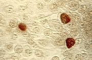 ملف:ChlamydiaTrachomatisEinschlusskörperchen.jpg