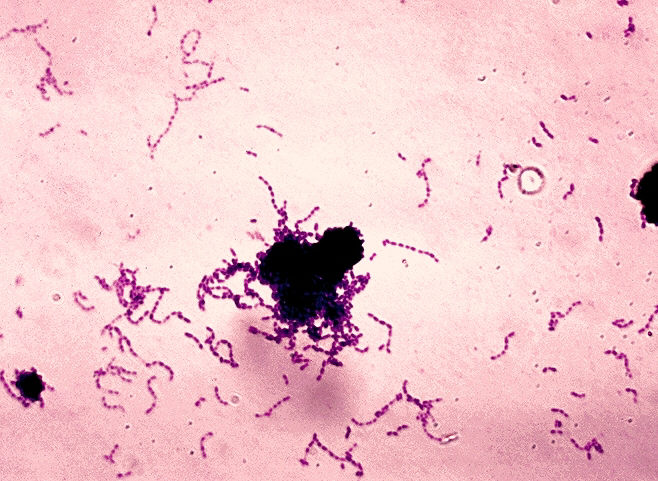 ملف:Streptococcus mutans 01.jpg