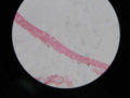 Pseduostratified columnar ciliated epithelium lining the bronchus (Light Microscope, Hemotoxin and Eosin dye, Magnified 600 times)