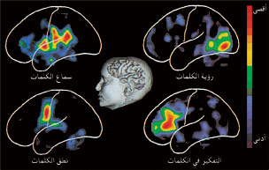 التصوير المقطعي بابتعاث البوزيترونات تقنية تستخدم في تصوير نشاط الدماغ. توضح الصور إلى اليسار، المأخوذة باستخدام هذه التقنية، مناطق نصف الكرة المخية الأيسر، النشطة أثناء أداء الشخص المهارات اللغوية. وتوضح الخطوط البيضاء المخ وشقيه الجانبي والمركزي. وتكون العصبونات في أقصى حالات نشاطها في المناطق الحمراء اللون، ويقل النشاط كلما انتقل اللون عبر الطيف الممتد من الأحمر إلى البنفسجي.