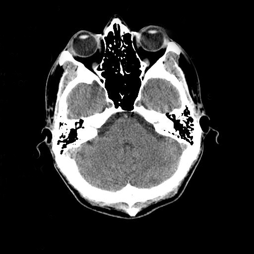 ملف:Head CT scan.jpg
