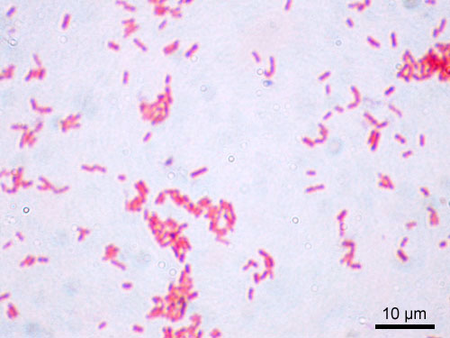 ملف:Escherichia coli Gram.jpg