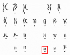 Human male karyotpe high resolution - Chromosome 21.png