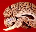 Human brain midsagittal view