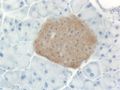 Mouse islet immunostained for insulin