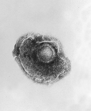 Electron micrograph of a "Human alphaherpesvirus 3" virus