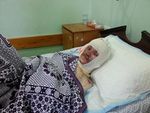 فلسطيني مصاب بحروق بنسبة 30% جراء إحدى الغارات الإسرائيلية على غزة، يوليو 2014.