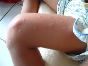 West-Nile-Virus-mosquito1.jpg