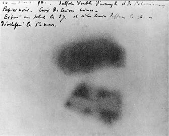 The photographic plate of Henri Becquerel, the first documented evidence of the radioactivity of uranium (1896)