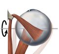 حركة العضلة المستقيمة السفلية للعين، صورة علوية.