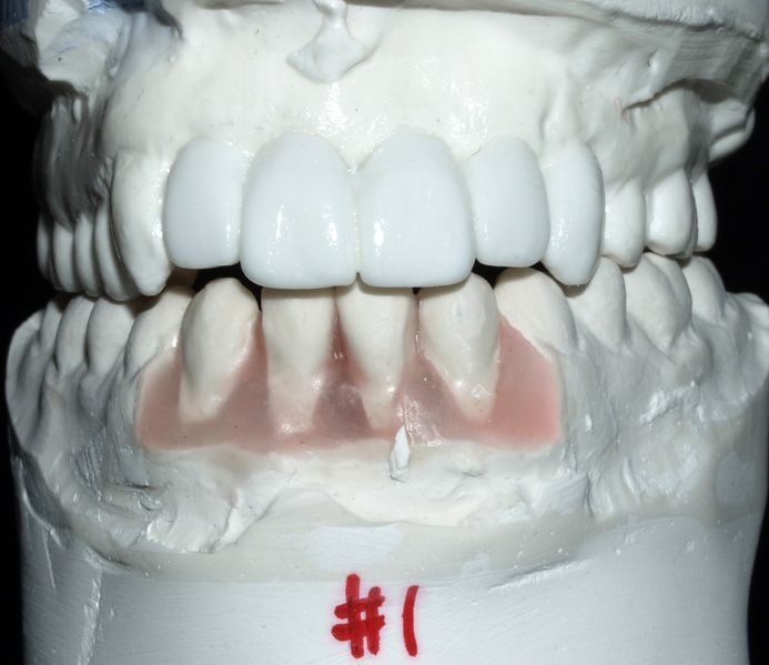 ملف:Dental setup for implants.jpg