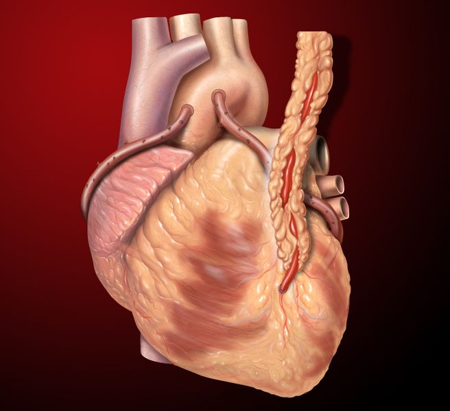 ملف:Heart saphenous coronary grafts.jpg