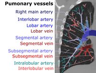 On CT scan, pulmonary emboli can be classified according to level along the arterial tree.