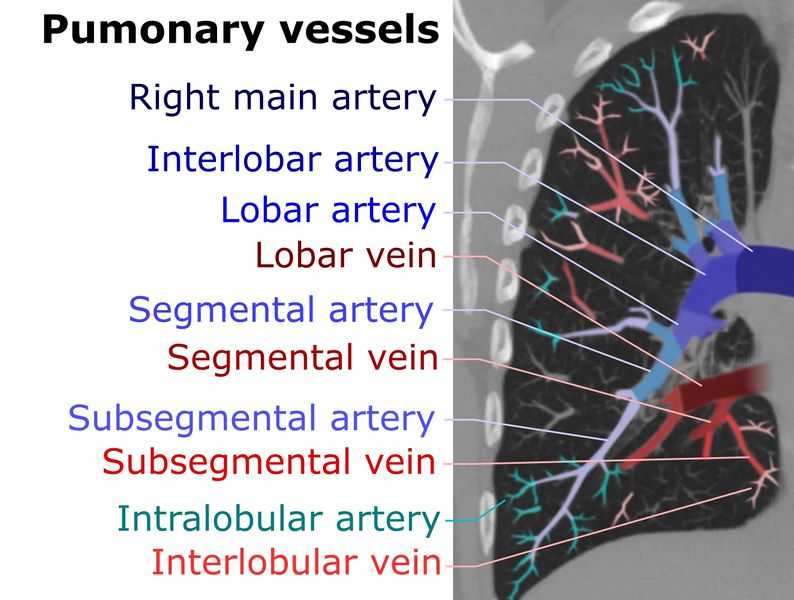 ملف:Computed tomograph of pulmonary vessels.jpg