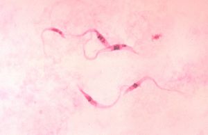 Promastigotes of Leishmania tropica.jpg