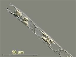 Guinardia delicatula, a diatom responsible for diatom blooms in the North Sea [69]