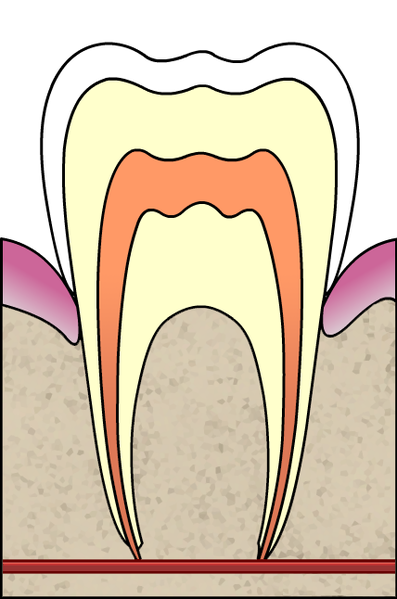 ملف:Cavities evolution 1 of 5 ArtLibre jnl.png