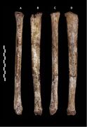 (A,B,C,D) Views of one tibia