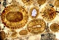 Thin-section view of a Middle Jurassic limestone in southern Utah. The round grains are ooids; the largest is 1.2 mm in diameter. This limestone is an oosparite.