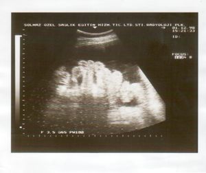 Ultrasound Scan ND 232.jpg
