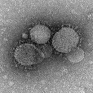 جزيئات MERS-CoV كما يراها الفحص المجهري الإلكتروني. تحتوي الفيروسات على نتوءات مميزة تشبه الهراوات تنبثق من الغشاء الفيروسي.