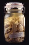 Portions of Brain of Charles Guiteau, Assassin of President James A. Garfield - Date received June 30, 1882 - ACC 0021876.jpg