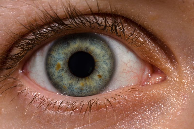 ملف:Human eye with blood vessels.jpg