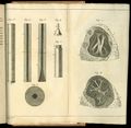 De l’auscultation médiate.... Drawings of the stethoscope and lungs.
