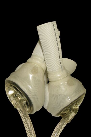 CardioWest™ temporary Total Artificial Heart.jpg