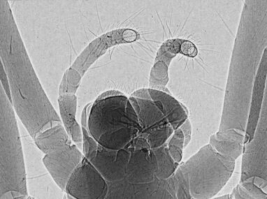 Figure 26. High resolution phase-contrast x-ray image of a spider