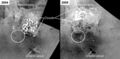 Two separate images of lakes in Titan's southern hemisphere taken one year apart.