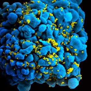 صورة مجهرية لخلية تائية مصابة بڤيروس نقص المناعة البشرية