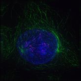 Early prophase: Nonkinetochore microtubules, shown as green strands, have established a matrix around the degrading nucleus, in blue. The green nodules are the centrosomes.