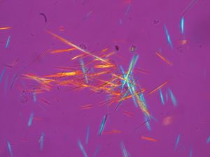 numerous multi-coloured needle-shaped crystals against a purple background