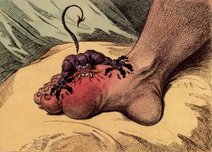 A small creature with sharp teeth is biting into a swollen foot at the base of the big toe
