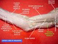Triceps brachii muscle (of newborn)