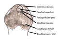 شكل يمثل كيفية عبور العصب البكري للخط الناصف قبل خوجه من الدماغ