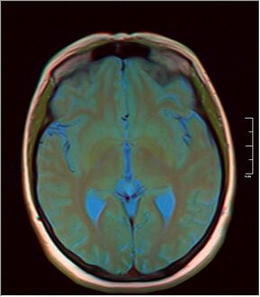 MRI axial in false color