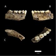 (A,B,C,D) Views of one lower jaw